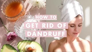 How to Get Rid of Dandruff  Home Remedies [upl. by Anihs584]