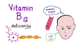 Vitamin B12 Cobalamin Deficiency  Causes Symptoms Diagnosis amp Management  Hematology Series [upl. by Kola]