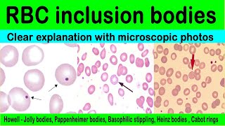 Inclusion bodies  red blood cell inclusions bodiesdetailsmicroscopic photos [upl. by Nrev618]