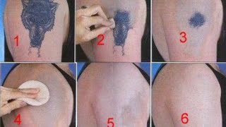 How to Remove a Tattoo without Laser at Home [upl. by Ynhoj207]