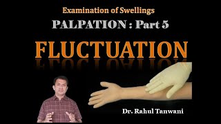 Palpation of Swellings  Part 5  Fluctuation [upl. by Dulce529]