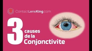 La Conjonctivite de Loeil  3 Causes de Rougeurs Dans les Yeux [upl. by Neveda180]