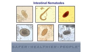 Diagnostic Features of Intestinal Nematodes [upl. by Alesandrini]