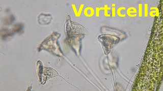 Vorticella  Under the Microscope [upl. by Loleta]