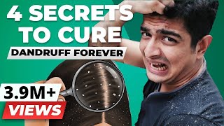 4 SECRET Tips To Remove Dandruff Forever  BeerBiceps Health [upl. by Eidarb]