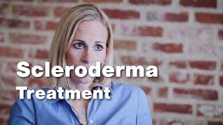 Treating Scleroderma  Johns Hopkins [upl. by Arathorn]