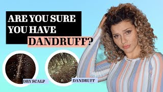 THE DIFFERENCE BETWEEN DANDRUFF VS DRY SCALP  TREATMENTS [upl. by Nwotna]