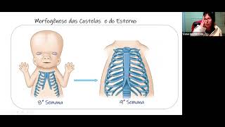 Embriologia do Sistema Esqueletico e Muscular [upl. by Nylak]