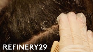 I Got A Scalp Facial To Treat Dandruff  Macro Beauty  Refinery29 [upl. by Randell]