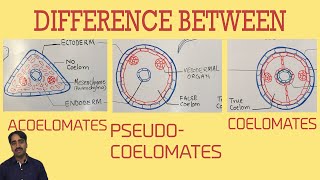 Acoelomates Pseudocoelomates and coelomates  Triploblastic organisation [upl. by Senalda]