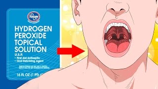 10 Surprising Uses For Hydrogen Peroxide YOU NEED TO KNOW [upl. by Poul555]