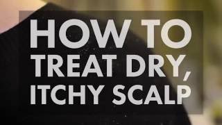 How to Treat a Dry Itchy Scalp  WebMD [upl. by Enwad]